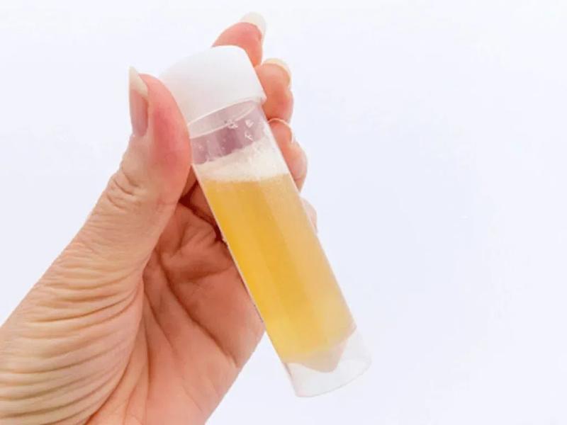 Sáng ngủ dậy thấy 5 dấu hiệu này, cẩn trọng vì có thể thận đang "lâm nguy": Có 1 cũng cần đi khám gấp- Ảnh 2.