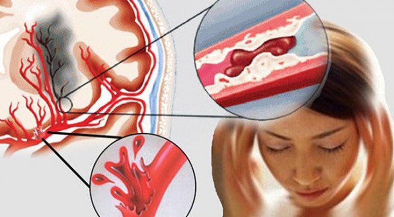 Nữ MC đột ngột qua đời ở tuổi 27: Cảnh báo thói quen sống âm thầm 