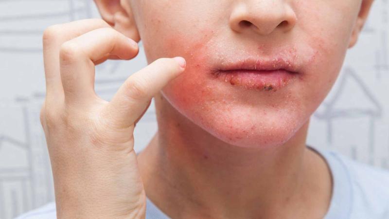 Người có gan yếu thường có 4 điểm chung trên khuôn mặt: Có 1 cũng nên đi khám ngay!- Ảnh 3.