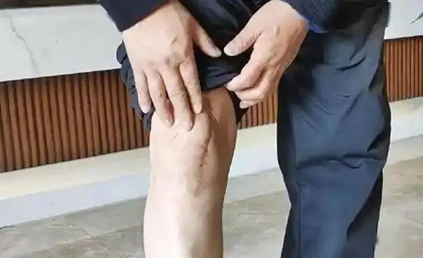 Đàn ông có già đi hay không, nhìn 