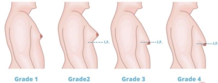 Căn bệnh khiến nam giới mặc cảm, mất tự tin trong các mối quan hệ- Ảnh 1.