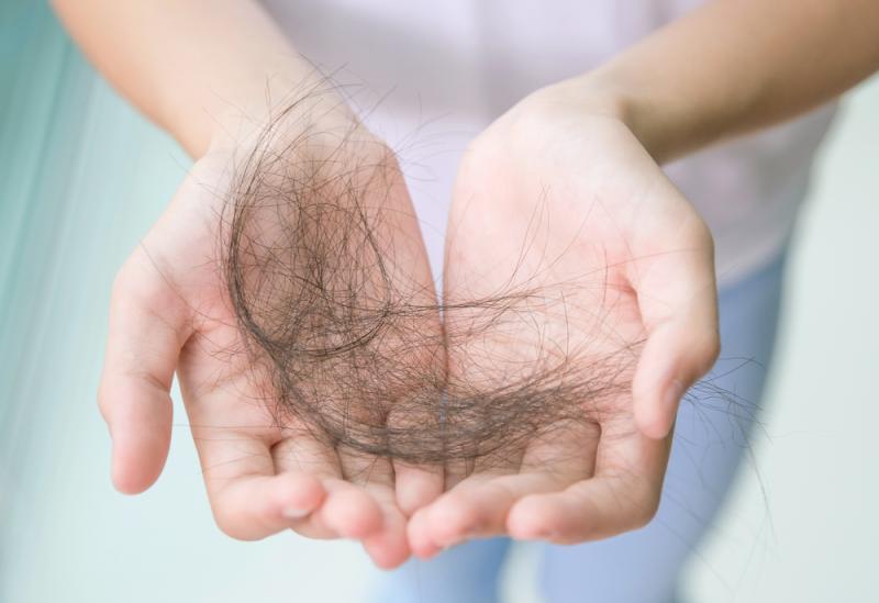 Có cách chữa rụng tóc ở tuổi mãn kinh không? Có 2 lời khuyên cho bạn, gội đầu theo cách này chính là "chìa khóa"- Ảnh 3.