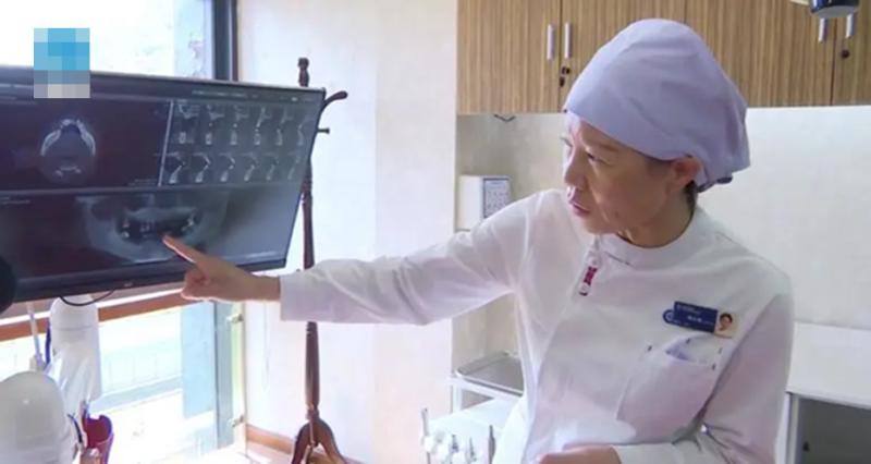 Người phụ nữ 44 tuổi rụng gần hết răng vì thói quen ai cũng dễ bỏ qua- Ảnh 1.