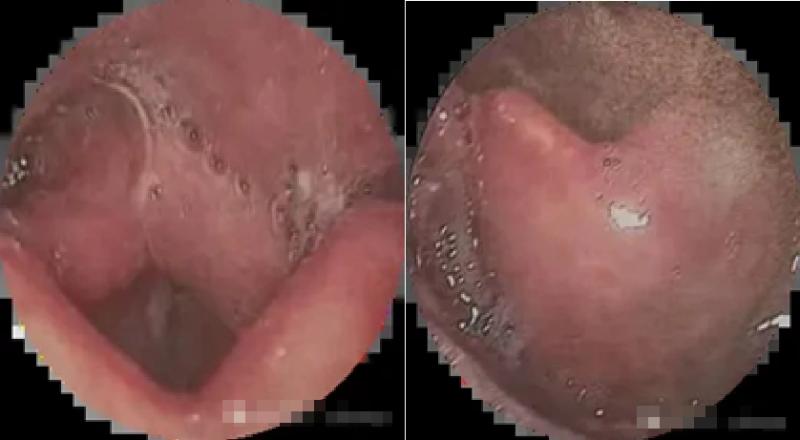 Chụp ảnh ở bãi cỏ, cô gái suýt chết ngạt- Ảnh 2.