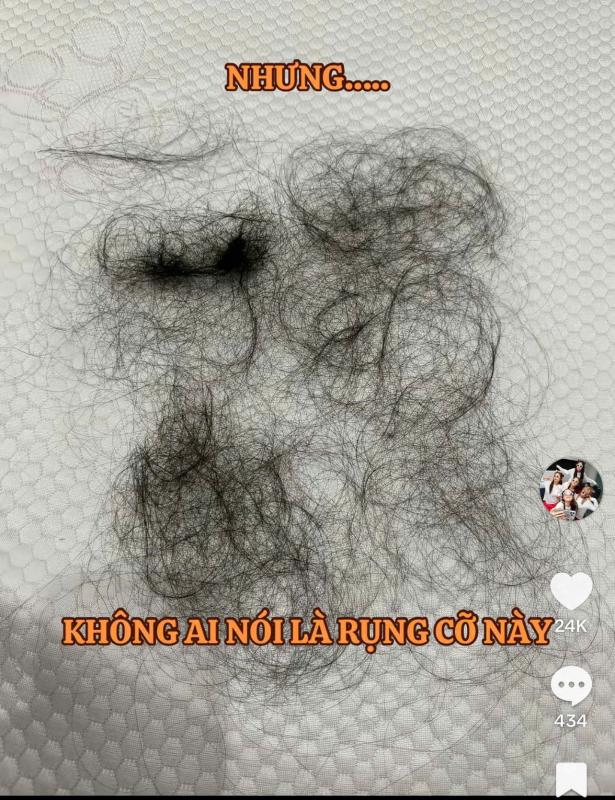 Puka gây lo lắng khi tóc rụng la liệt thành từng mảng sau khi sinh con đầu lòng- Ảnh 2.