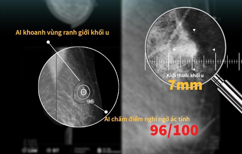 Nếu chỉ mất 26k/ngày để tầm soát ung thư, bạn có sẵn sàng đầu tư?- Ảnh 2.