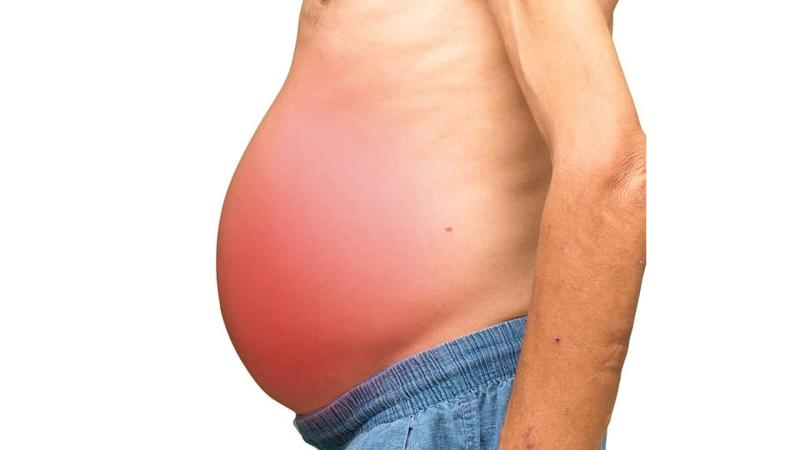Khi gan suy nặng, cơ thể sẽ sưng ở 5 chỗ: Có 1 cũng nên đi khám ngay- Ảnh 4.