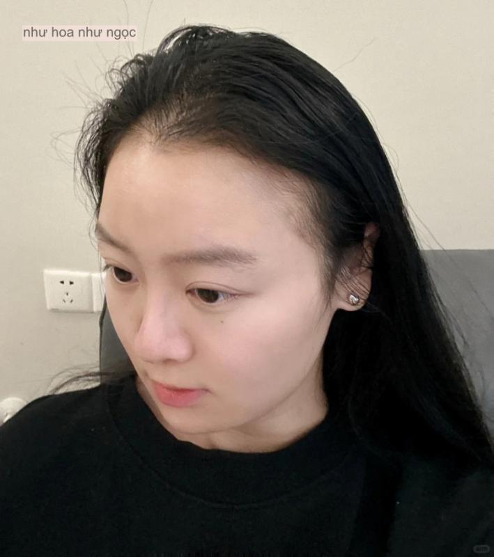 Tôi mất 5 năm để biến mái tóc thưa thớt trở nên dày dặn và bồng bềnh trở lại- Ảnh 4.