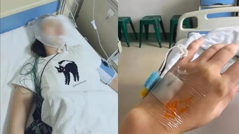 Dầm mưa 10 phút, người phụ nữ bị viêm màng não- Ảnh 1.