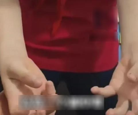 Bé trai 11 tuổi tay co giật, khó thở sau khi làm bài tập về nhà suốt 14 tiếng- Ảnh 1.