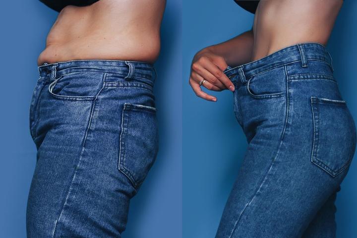 Phẫu thuật ‘nắn’ xương sườn giúp cô gái gen Z có vòng eo con kiến, giảm 15cm- Ảnh 1.