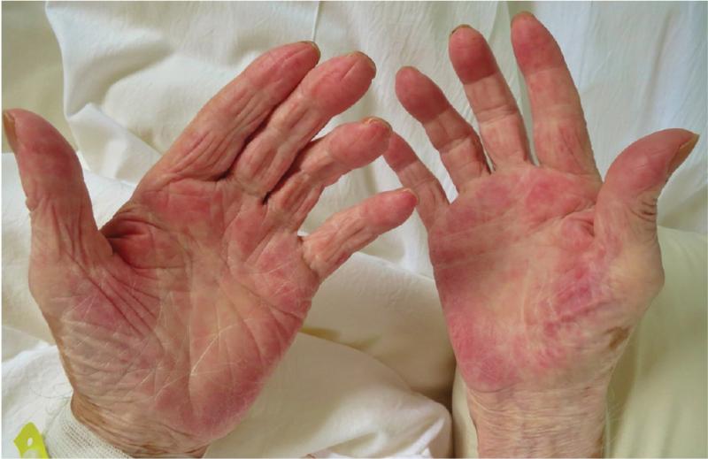 Nếu cơ thể có "2 đỏ, 2 hôi, 2 ngứa" này, cần tầm soát ung thư gan trước khi quá muộn!- Ảnh 1.