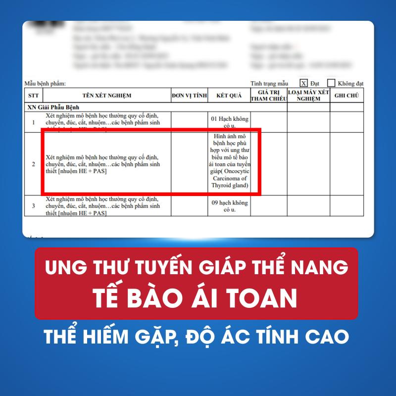 Bé trai 13 tuổi mắc ung thư tuyến giáp, phát triển nhanh chỉ trong vài tuần- Ảnh 2.