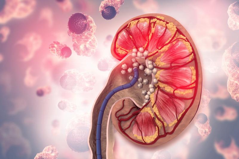 Người có axit uric máu cao thường có 3 đặc điểm này khi ăn uống: Có 1 cũng khiến thận sớm suy hỏng- Ảnh 1.