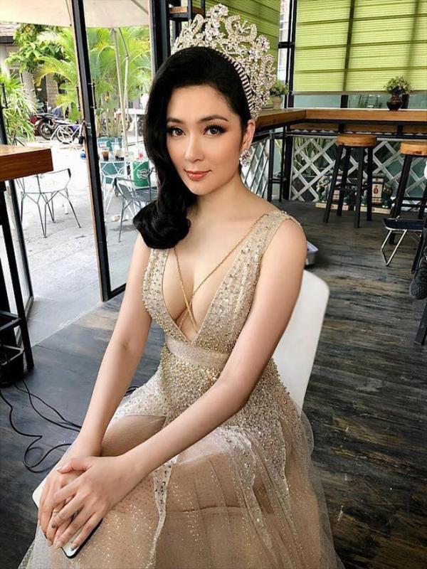 Hoa hậu Việt mắc bệnh lạ: Thường lên cơn co giật, bị bệnh viện trả về, 10 ngón tay đều có sẹo- Ảnh 2.