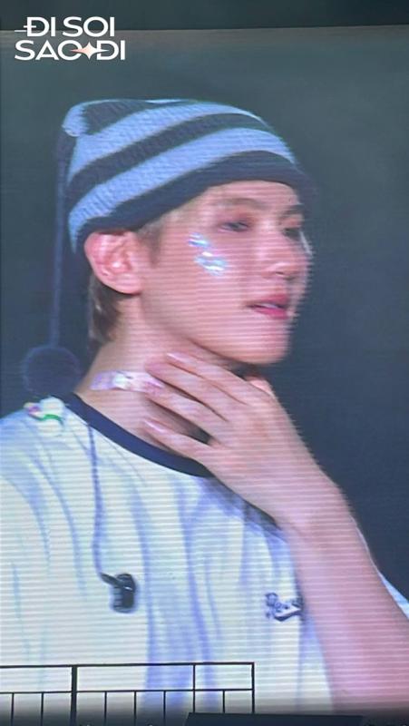 Nam thần Kpop sang Việt Nam vấp chân suýt vồ ếch trên sân khấu, mẩn đỏ dị ứng lan khắp cổ- Ảnh 6.