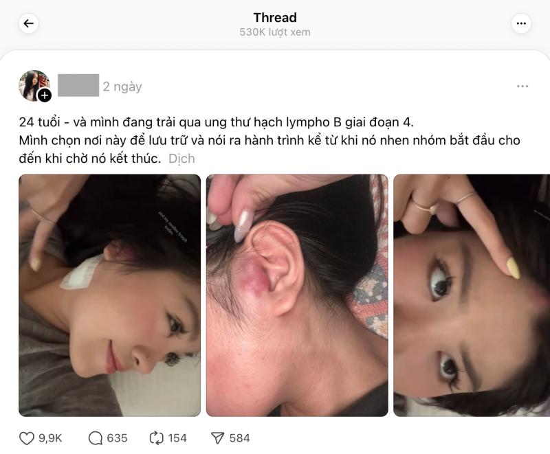 Cô gái TP.HCM 24 tuổi bị ung thư hạch giai đoạn 4: Bác sĩ nói lý do có thể đến từ... mọi thứ- Ảnh 2.