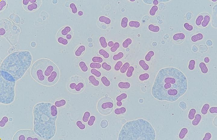 Hà Nội ghi nhận ca mắc não mô cầu là trẻ 11 tuổi, chưa tiêm vaccine- Ảnh 1.