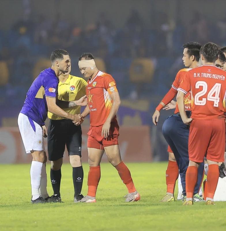 Trọng Hoàng bị Hoàng Hên giẫm rách tai ở V.League- Ảnh 2.