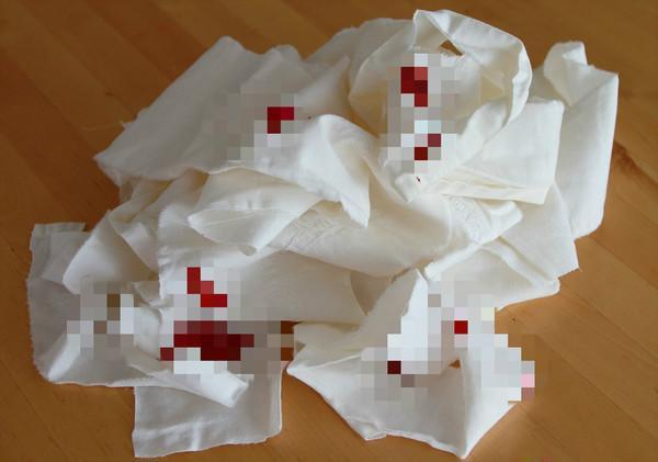 4 tín hiệu tử cung bị bệnh tật đeo bám, ung thư "rình rập" nhiều chị em có mà KHÔNG biết- Ảnh 2.
