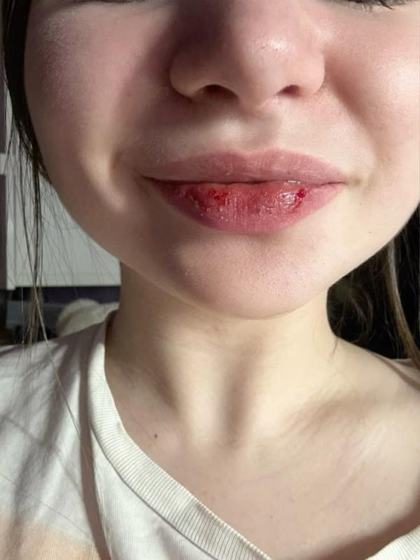 30 tuổi nhận ra dưỡng môi kiểu cũ không hiệu quả: 6 điều bạn cần thay đổi ngay khi trời lạnh- Ảnh 1.