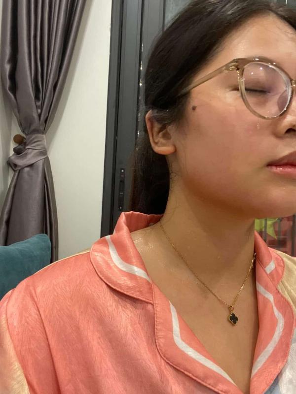 Bị nói 