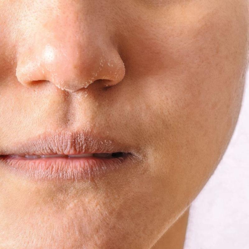 Đây là cách tôi dưỡng ẩm cho làn da tuổi 35 vào mùa hanh khô- Ảnh 1.