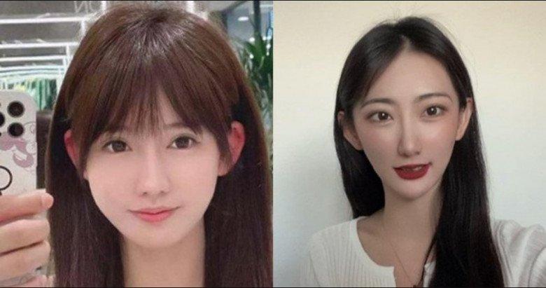 Cô gái khổ sở 30 năm vì tai giống Đoàn Di Băng- Ảnh 4.