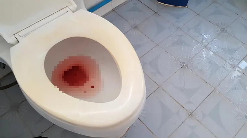 4 bất thường trong nước tiểu đang cố gào thét: Nhiều bệnh ung thư đang "lớn nhanh như thổi"- Ảnh 1. 4 bất thường trong nước tiểu đang cố gào thét: Nhiều bệnh ung thư đang "lớn nhanh như thổi"- Ảnh 1.