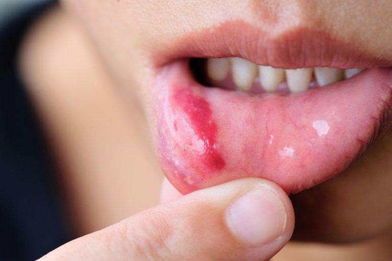 3 thứ màu đỏ "kỳ lạ" trên cơ thể thật ra là dấu hiệu ung thư cực ít người để ý- Ảnh 2.