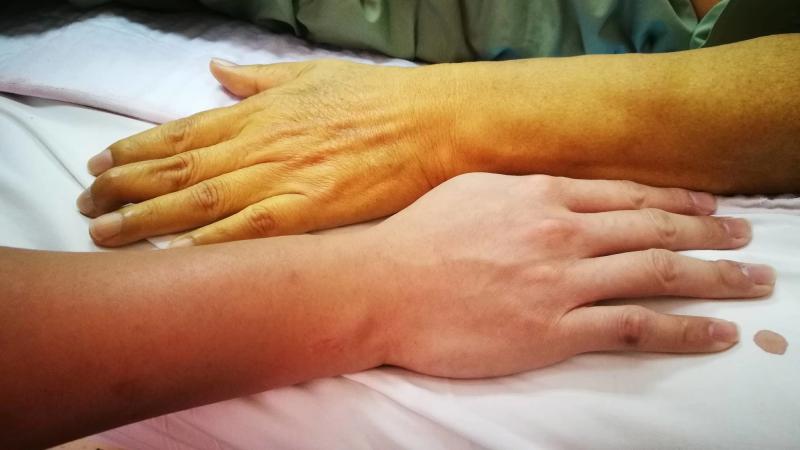 Nhìn tay và chân cũng có thể biết gan bị tổn thương hay không: Đây là 5 dấu hiệu cần lưu ý- Ảnh 3.