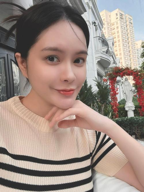 Cô gái khổ sở 30 năm vì tai giống Đoàn Di Băng- Ảnh 8.