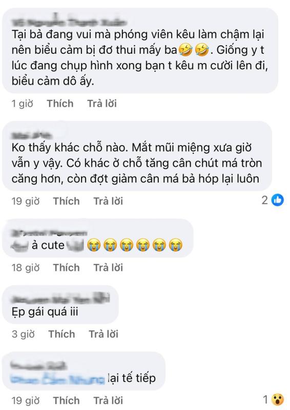 Cũng tới ngày Kim Ji Won bị soi quá đà: Mặt vậy mà vẫn chê?- Ảnh 3.