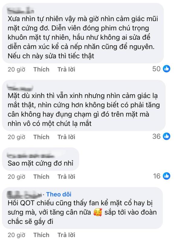 Cũng tới ngày Kim Ji Won bị soi quá đà: Mặt vậy mà vẫn chê?- Ảnh 2.