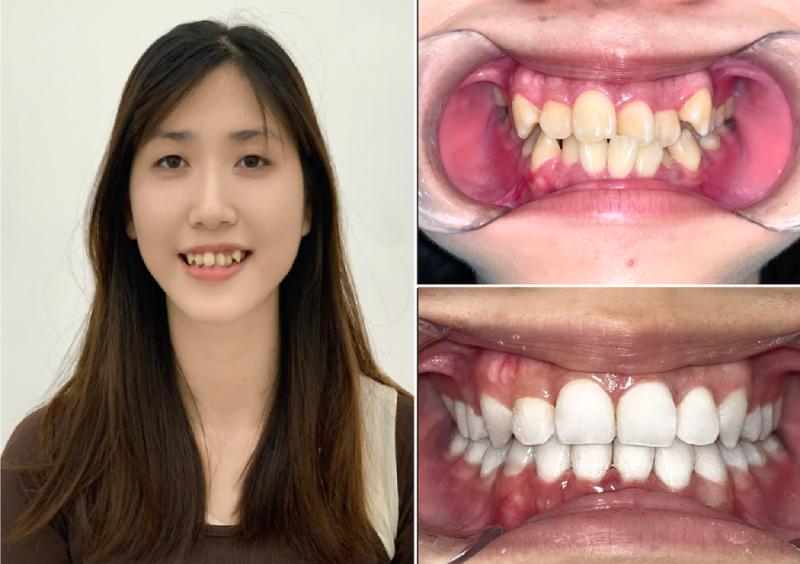 Phương pháp chữa bệnh nhiều người tưởng “chỉ để làm đẹp”- Ảnh 3.
