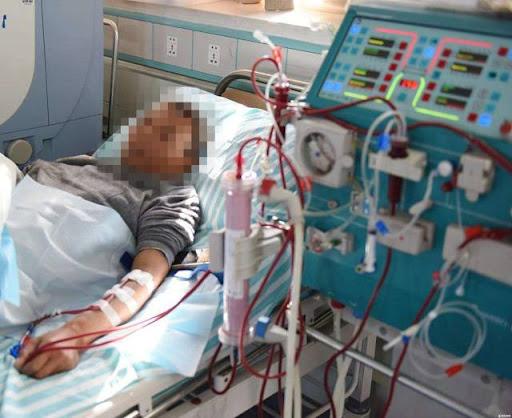 Thanh niên 20 tuổi thận teo nhỏ, mất chức năng vì bỏ qua 3 dấu hiệu cảnh báo- Ảnh 1.