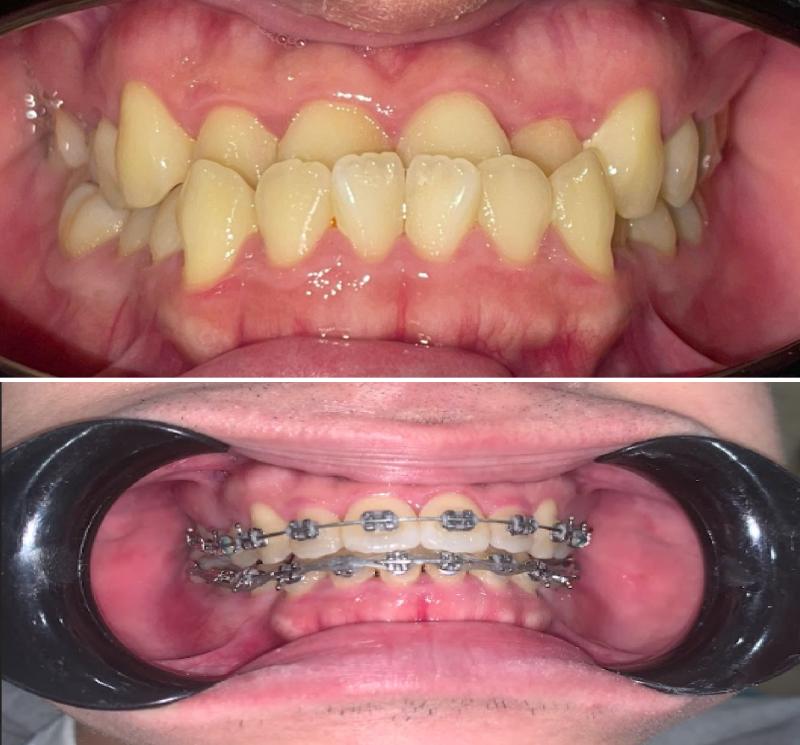 Phương pháp chữa bệnh nhiều người tưởng “chỉ để làm đẹp”- Ảnh 2.