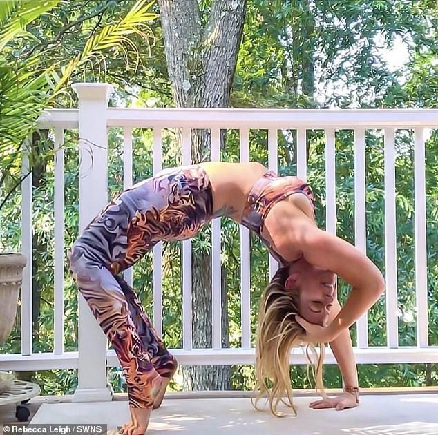 Người phụ nữ rách động mạch cổ, đột quỵ sau tư thế yoga "sống ảo"- Ảnh 3.