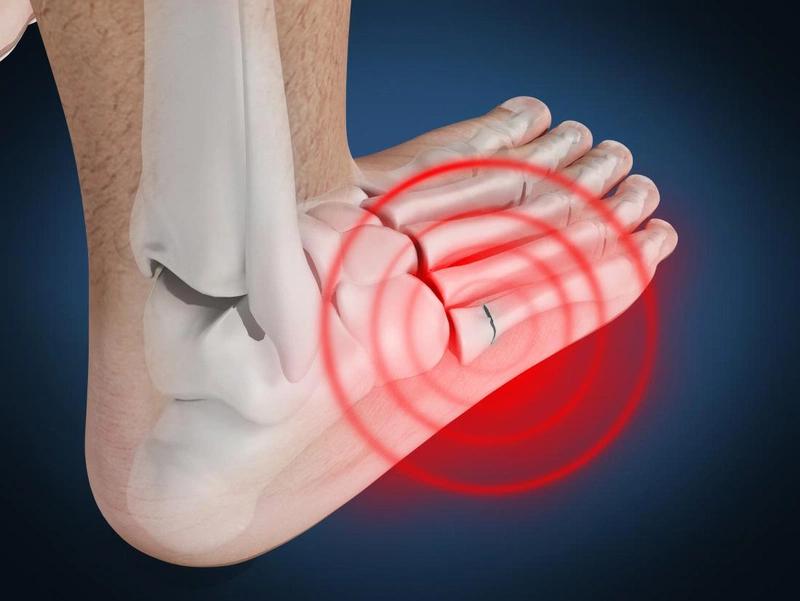 1 việc bị bỏ quên khi tập thể thao có thể khiến bạn "tàn phế"- Ảnh 2.