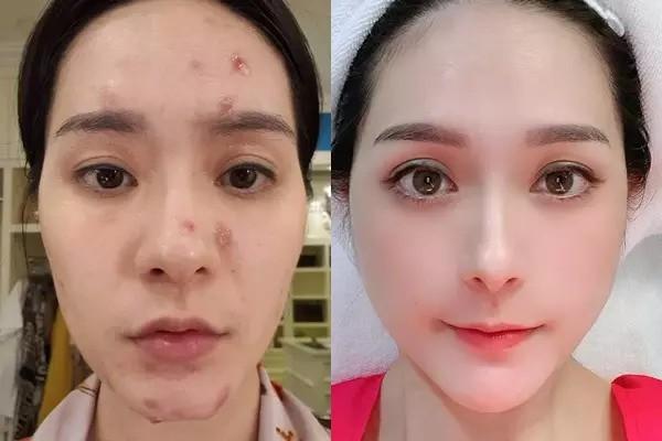 Nhan sắc Đoàn Di Băng trước khi đập tiền tấn vào làm đẹp- Ảnh 4.