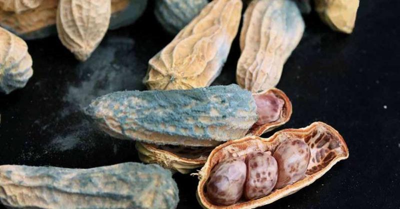 Đi khám vì khó tiêu, người phụ nữ phát hiện ung thư gan: BS hoảng hốt: 