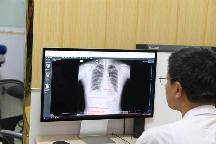 AI - 'con mắt thứ ba' giúp bác sĩ phát hiện sớm ung thư từ dấu hiệu nhỏ- Ảnh 1.