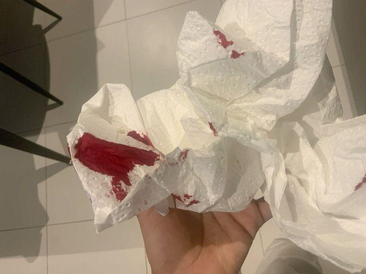 4 tín hiệu sớm nhất cơ thể phát ra để "cầu cứu" vì ung thư cổ tử cung, tiếc là ít chị em để ý- Ảnh 1.