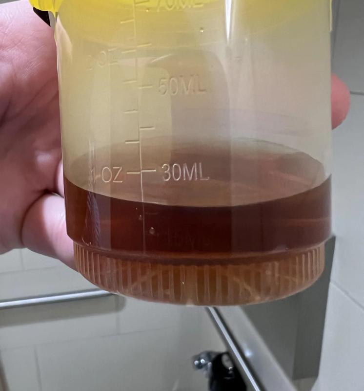 Cảnh báo: Bất kể nam hay nữ, nếu 3 thứ này trên người ngày càng “đen” chứng tỏ thận chất đầy độc tố- Ảnh 3.