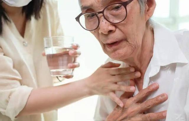 Không đau đầu nhưng vẫn có thể đột quỵ: 6 tín hiệu “im lặng” của nhồi máu não mà bác sĩ cũng lo ngại- Ảnh 3.