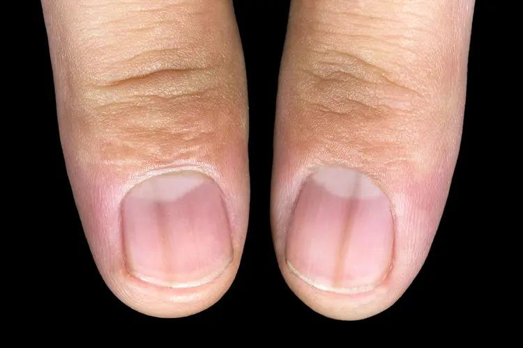 7 vị trí trên cơ thể thường chuyển sang MÀU ĐEN khi ung thư xuất hiện, tự kiểm tra ngay!- Ảnh 2.