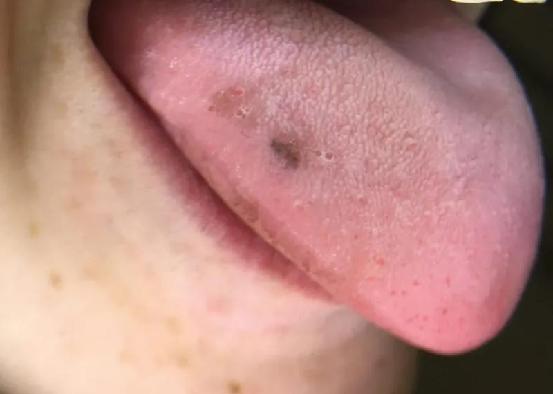 7 vị trí trên cơ thể thường chuyển sang MÀU ĐEN khi ung thư xuất hiện, tự kiểm tra ngay!- Ảnh 3.