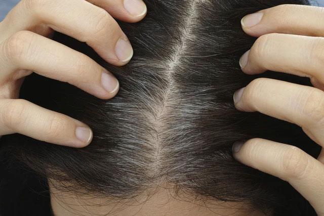 “Cái tóc là góc con người” - tóc thay đổi theo 5 kiểu này đồng nghĩa cơ thể đang mắc bệnh, ai cũng nên biết để phòng và sống thọ- Ảnh 3.