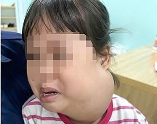 48 giờ sinh tử của bé gái 2 tuổi có khối u khổng lồ- Ảnh 2.