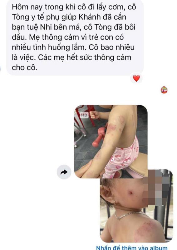 Phụ huynh bức xúc khi con gái hơn 2 tuổi chi chít vết cắn trên người sau giờ học- Ảnh 2.